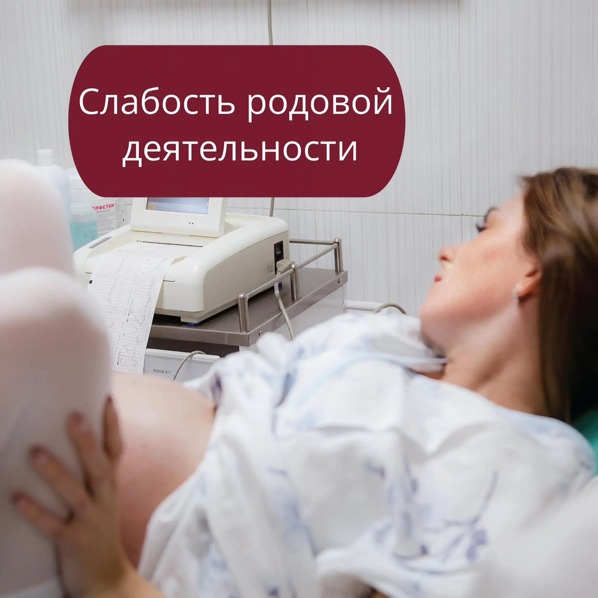 Слабость родовой деятельности (СРД) — это слабые и редкие схватки с медленным раскрытием шейки матки