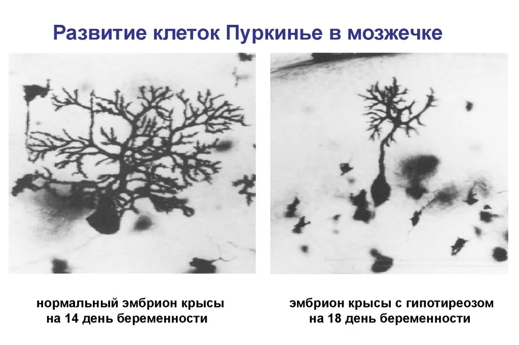 ✨Просто о сложном: йод и развитие малыша 

👩‍⚕️В нашей рубрике #Простоосложном врач-терапевт высшей