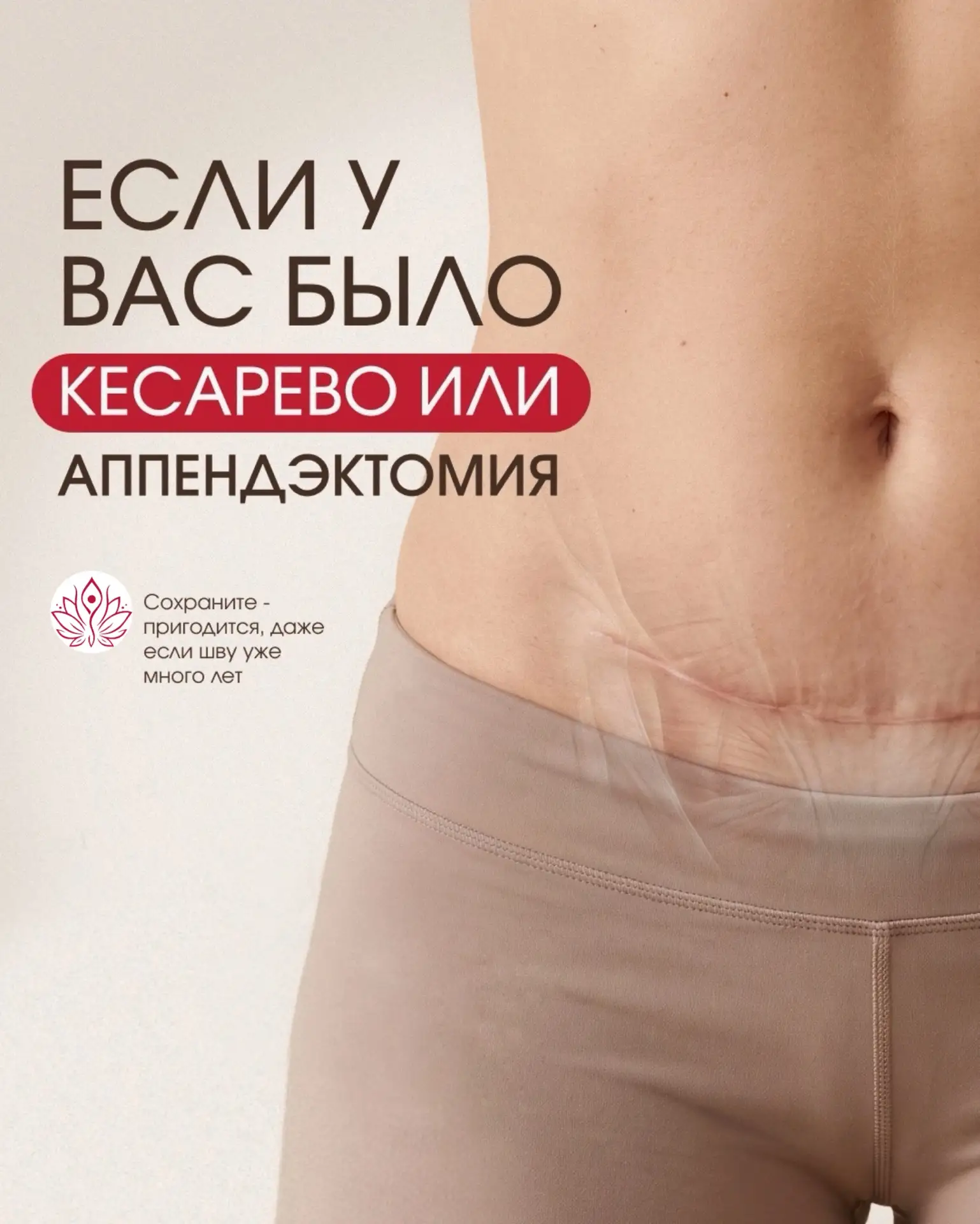 Кесарево сечение vs Естественные роды: