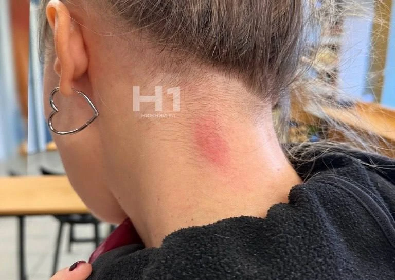 На Мещерском бульваре девушка попала под обстрел неизвестными предметами.