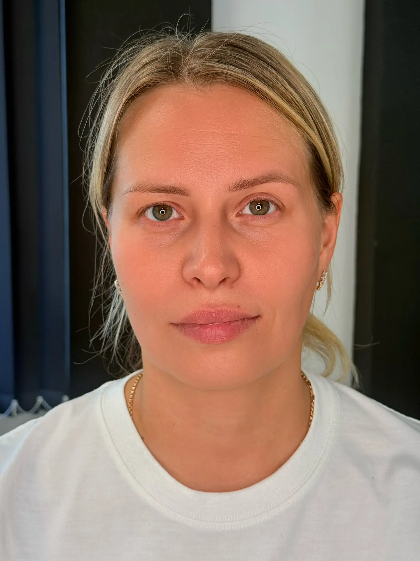 Вчера у меня была Елена, с запросом исправить ассиметрию на бровях