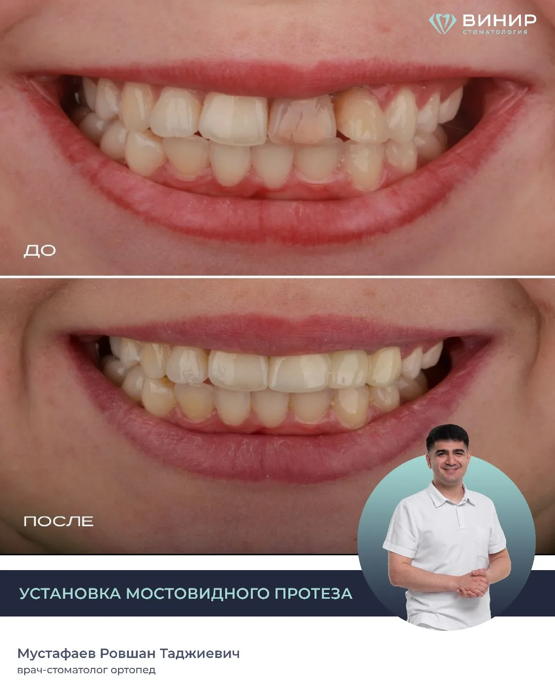 💎КЛИНИЧЕСКИЙ СЛУЧАЙ💎
