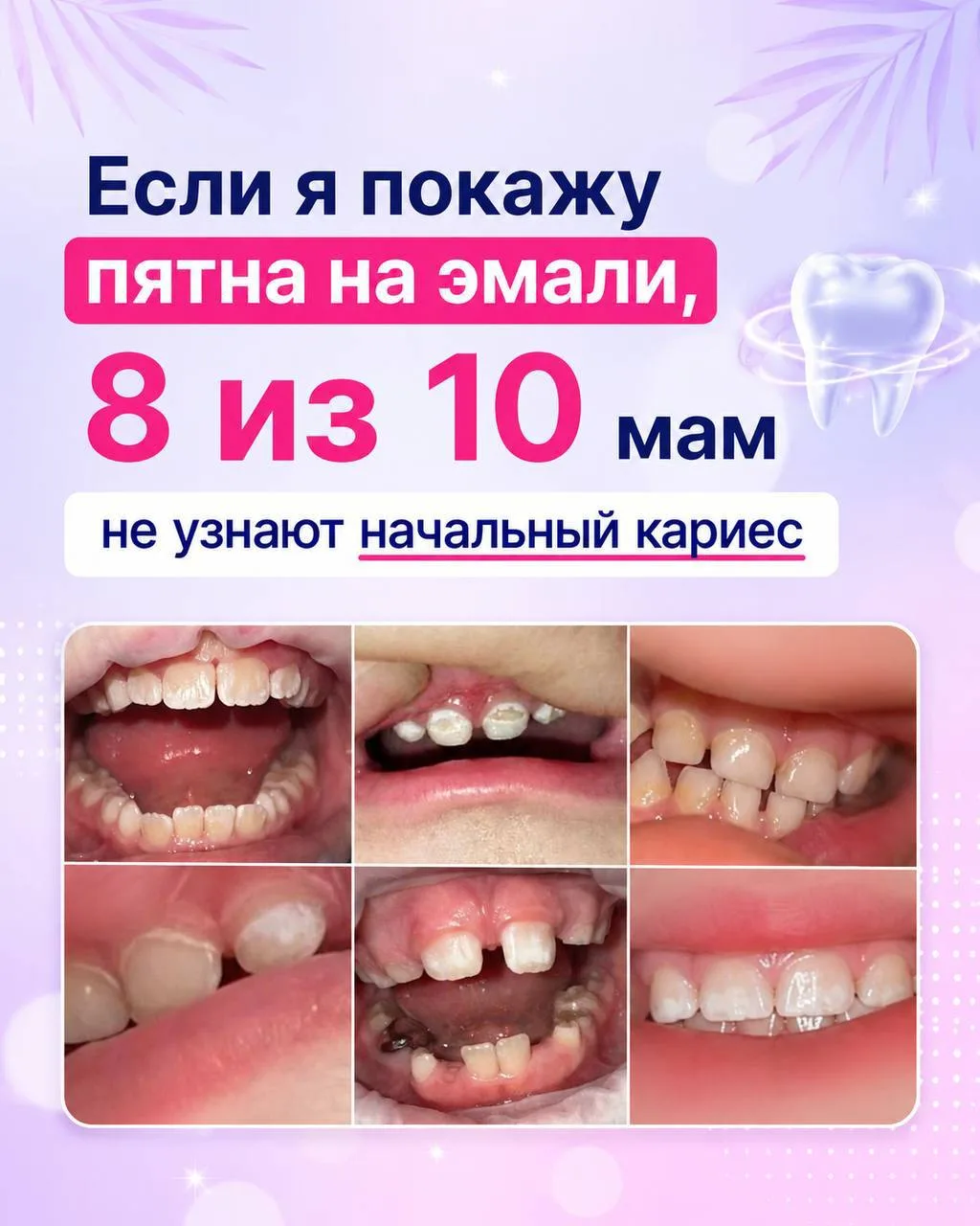 Если покажу эти фотографии 8 из 10 мам ошибутся.