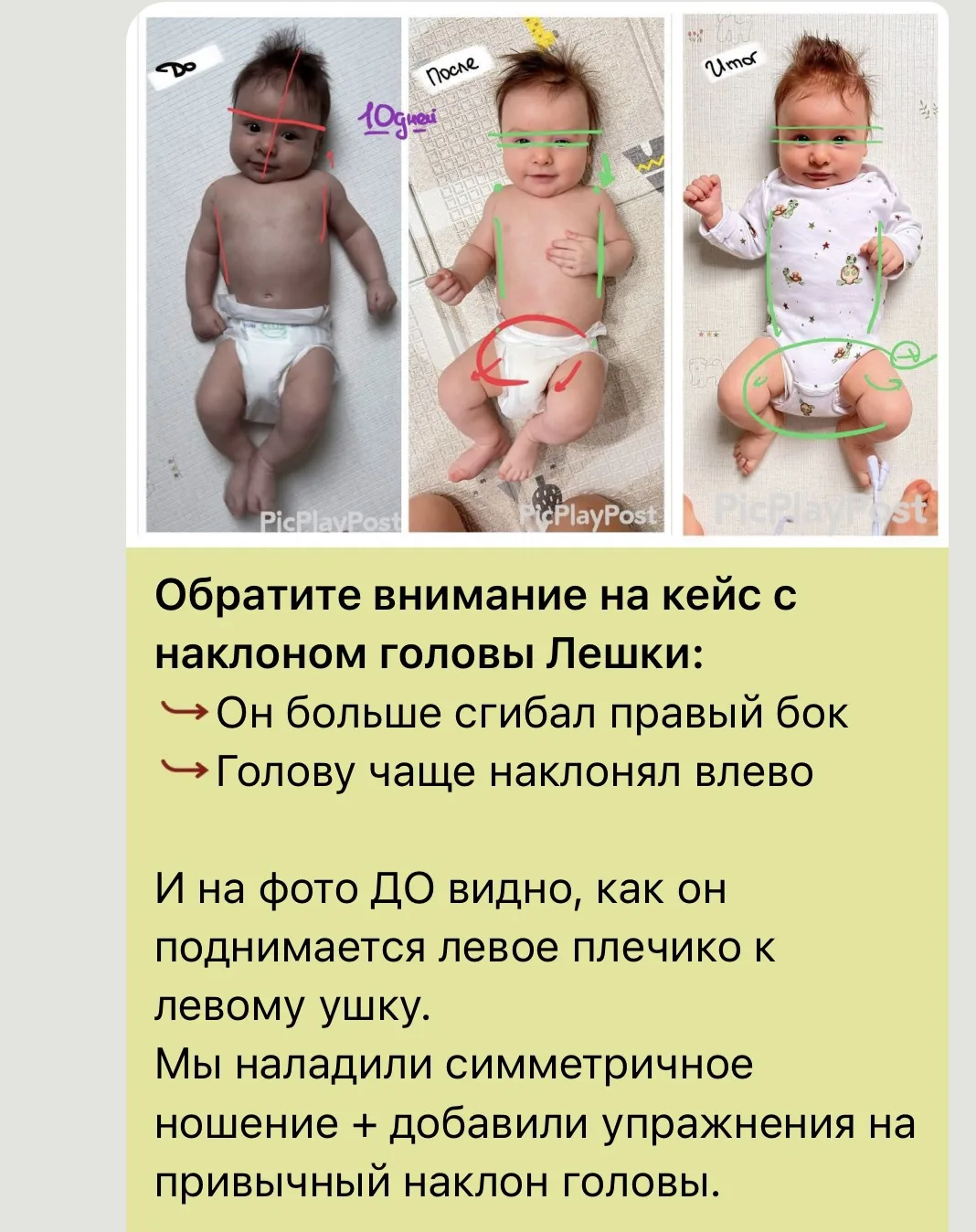 ‼️Последствия раненого партизана: выход в сидение на одну сторону и вставание с «любимо...