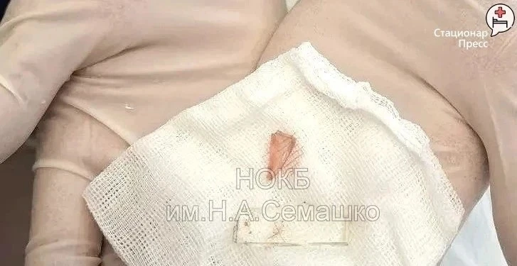 😱 Кусок стекла достали из шеи нижегородки в больнице им. Семашко

Женщина споткнулась в теплице и у