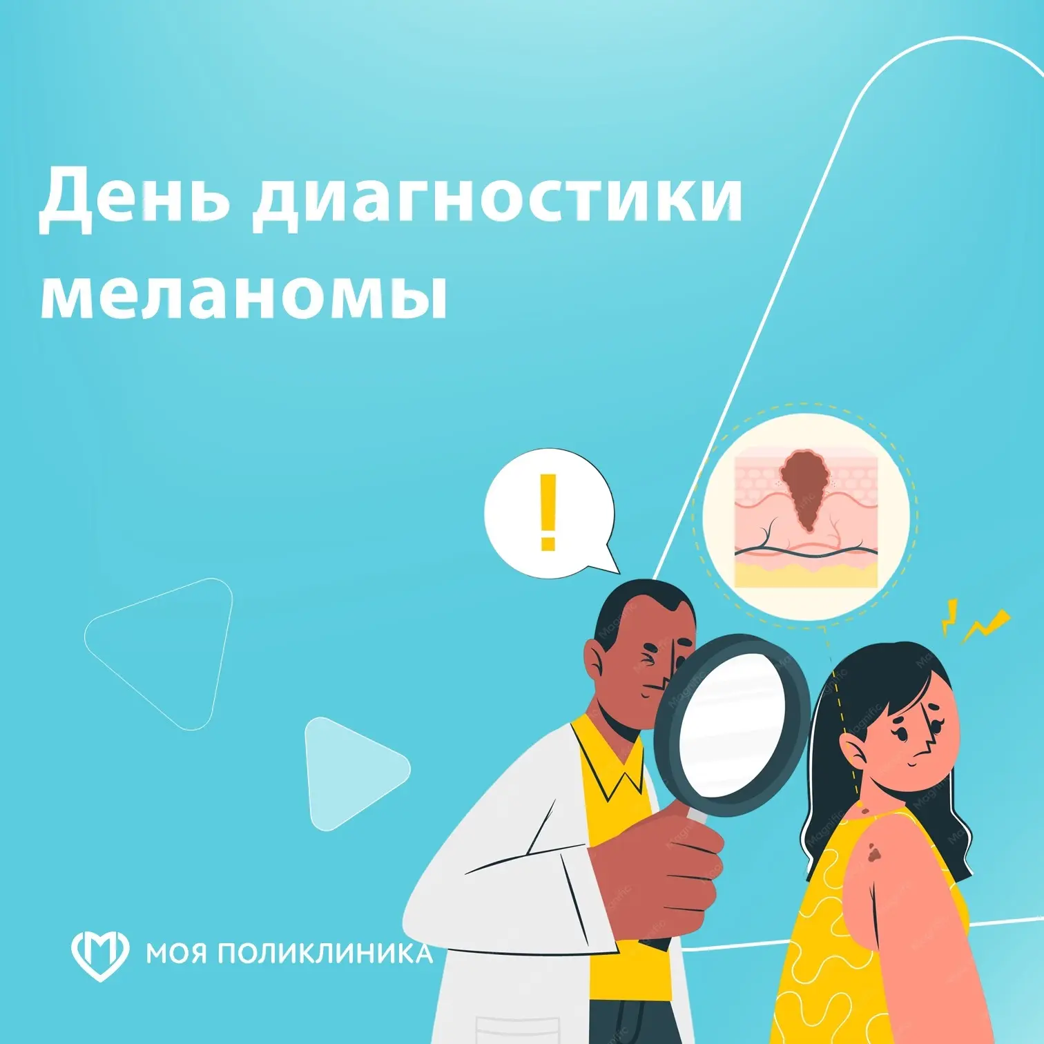 25 мая в России отмечается День диагностики меланомы — важная инициатива, призванная по...
