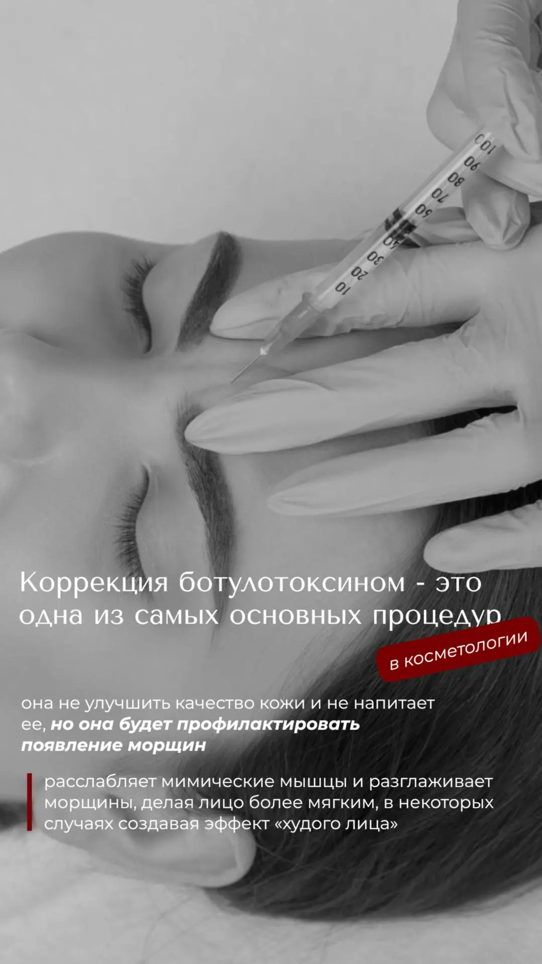 Зачем нам «заломы», если есть ботулотоксин? 🤷‍♀️