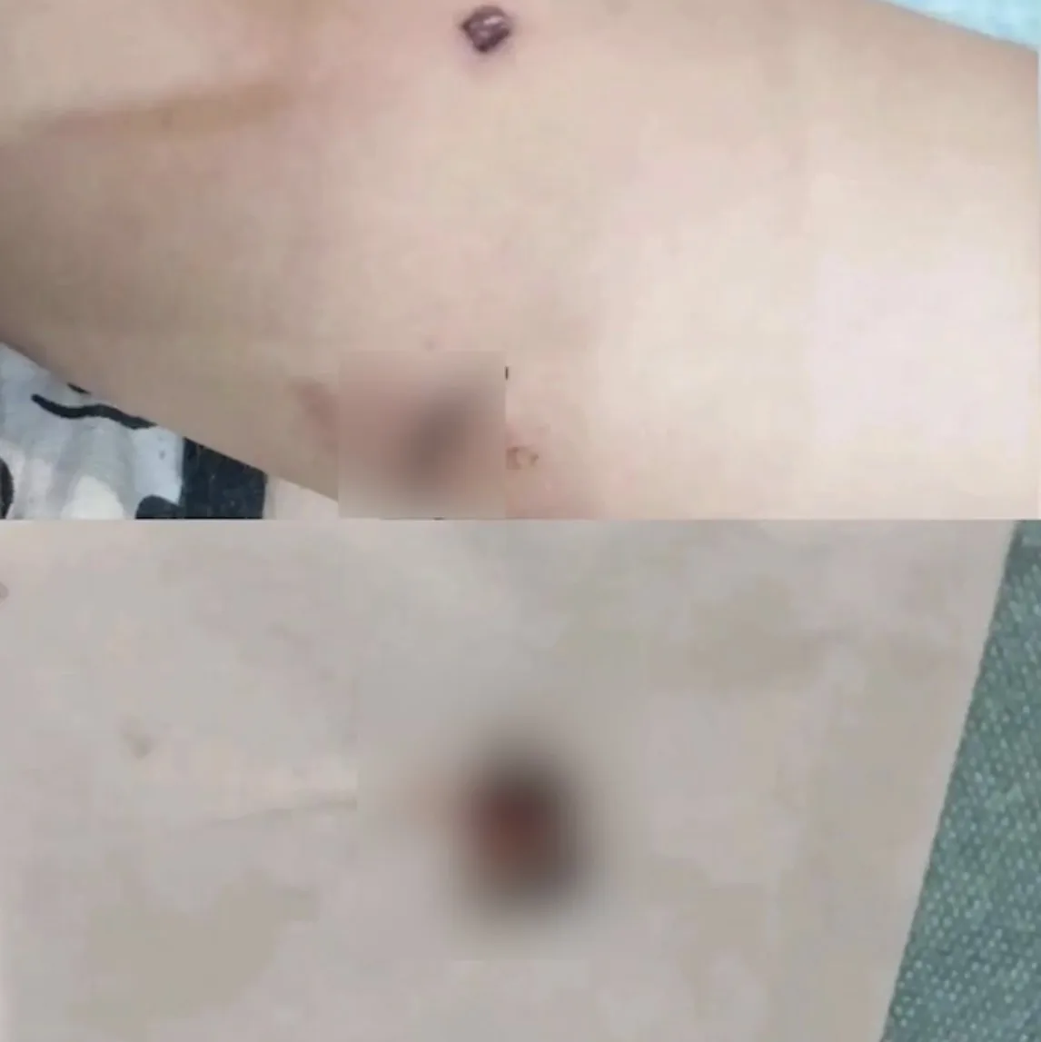 В Богучанском округе мужчина выстрелил в подростка из пневматической винтовки.