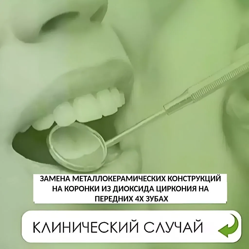 🔴Процедуру выполнила