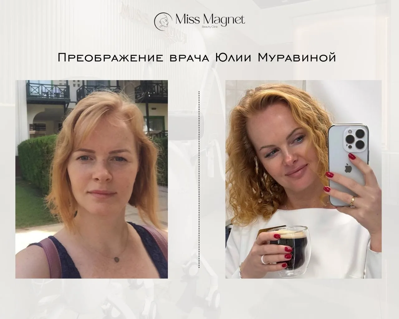 Красота от экспертов: Процедуры Юлии Муравиной