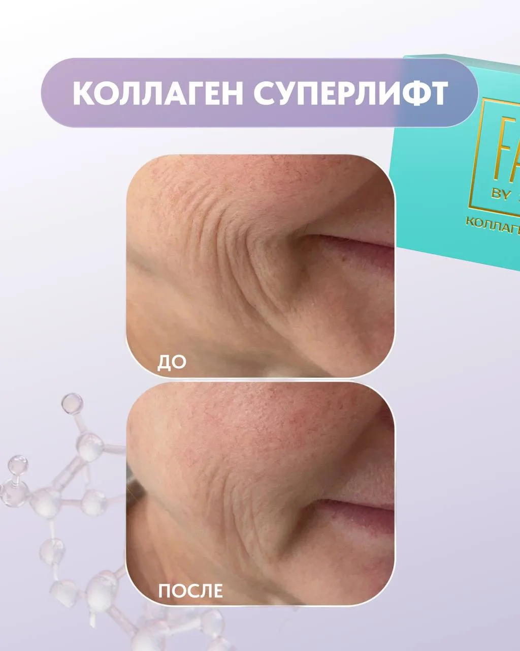 Коллагеностимуляция в действии ✔️