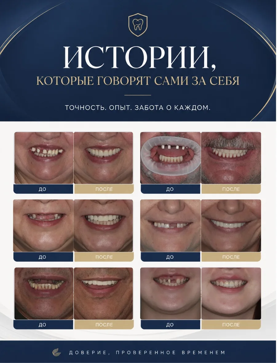 Вернуть зуб с понятной стоимостью лечения — реально!