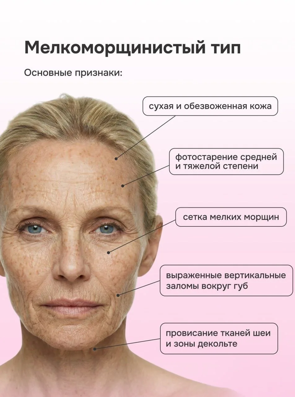 Как подобрать anti-age уход по типу старения?  Остановить время мы не можем, зато вполне способны до