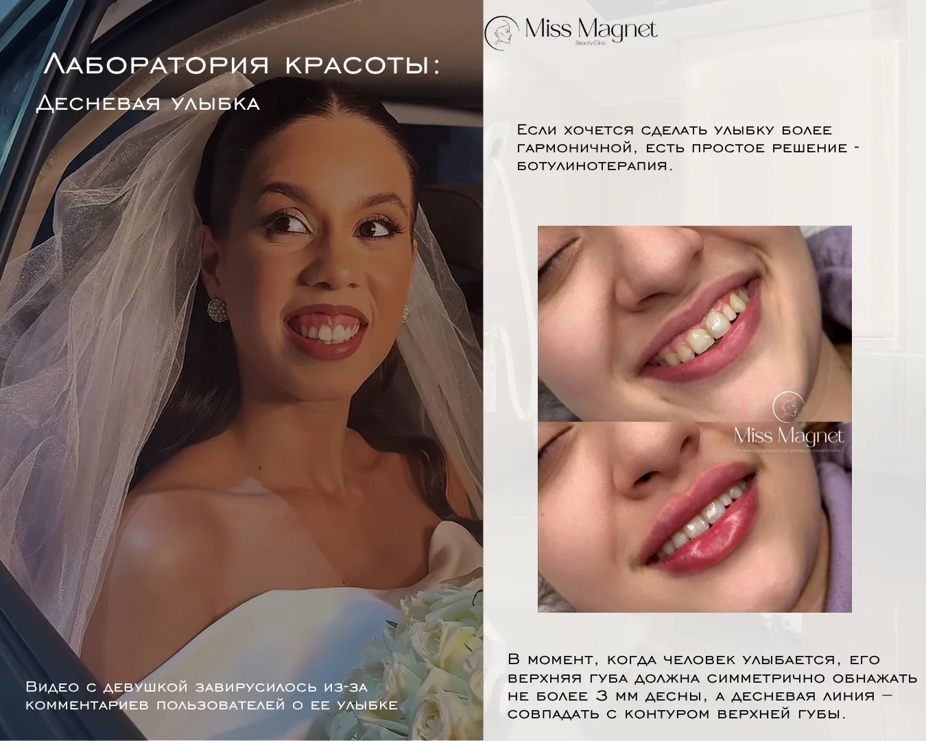 В сети эту девушку захейтили за «слишком открытую» улыбку.