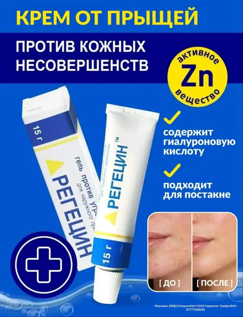 🤍Крем гель от прыщей акне постакне угрей