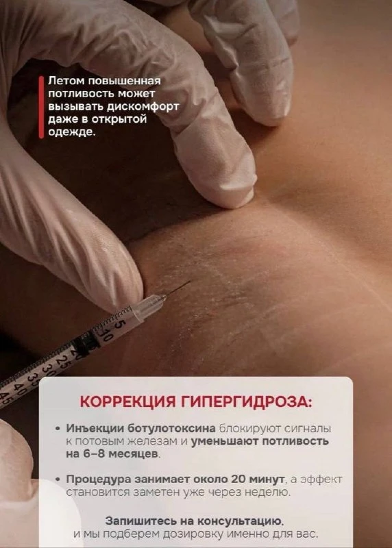 Прощай, пот: ботулотоксин против гипергидроза💦