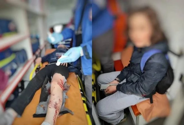 В Норильске стая бродячих собак напала на двоих подростков 12 и 13 лет возле мемориала «Норильская г