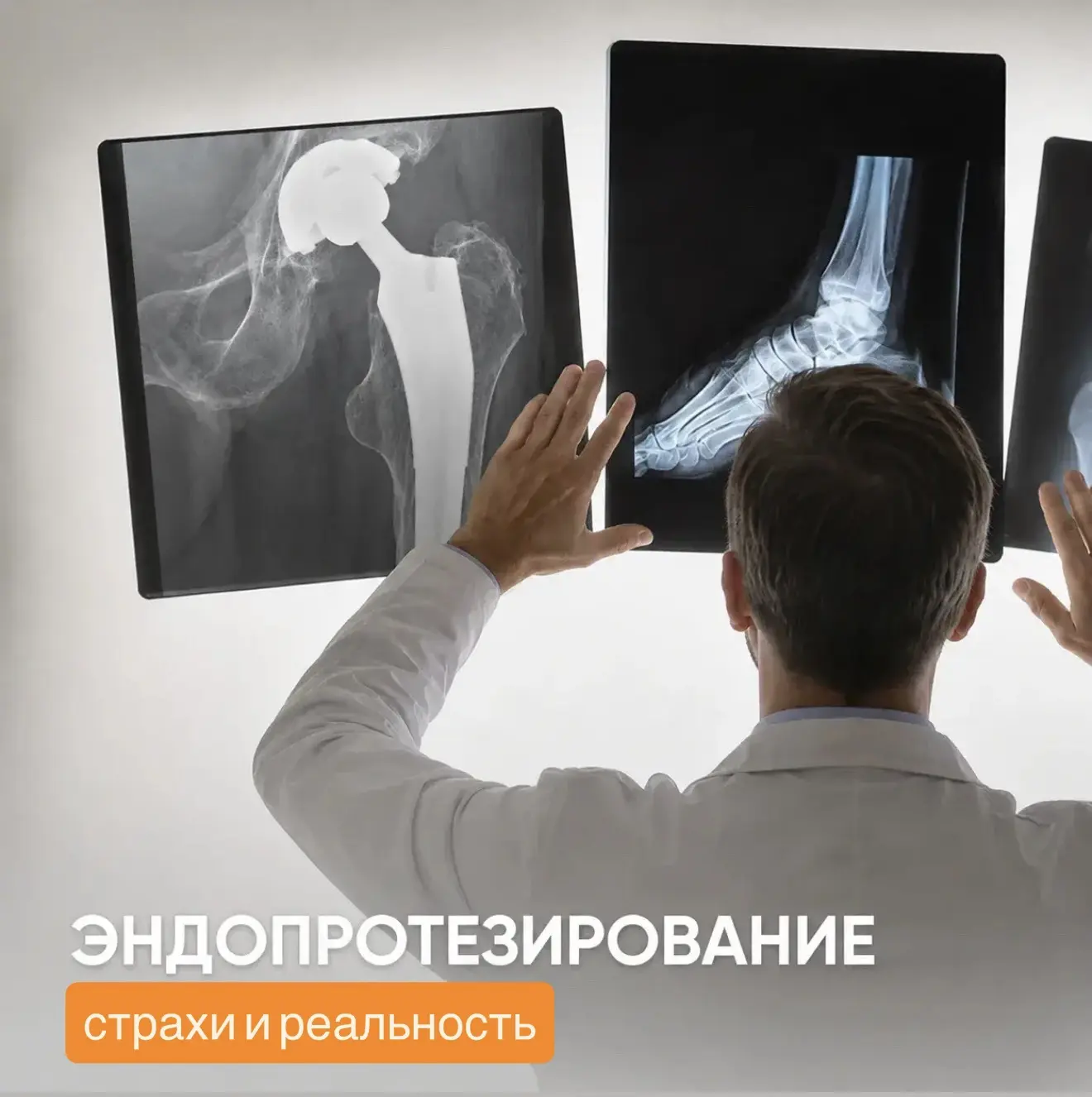 Для многих слово «операция» звучит пугающе. А если речь идет о замене сустава – тем бол...