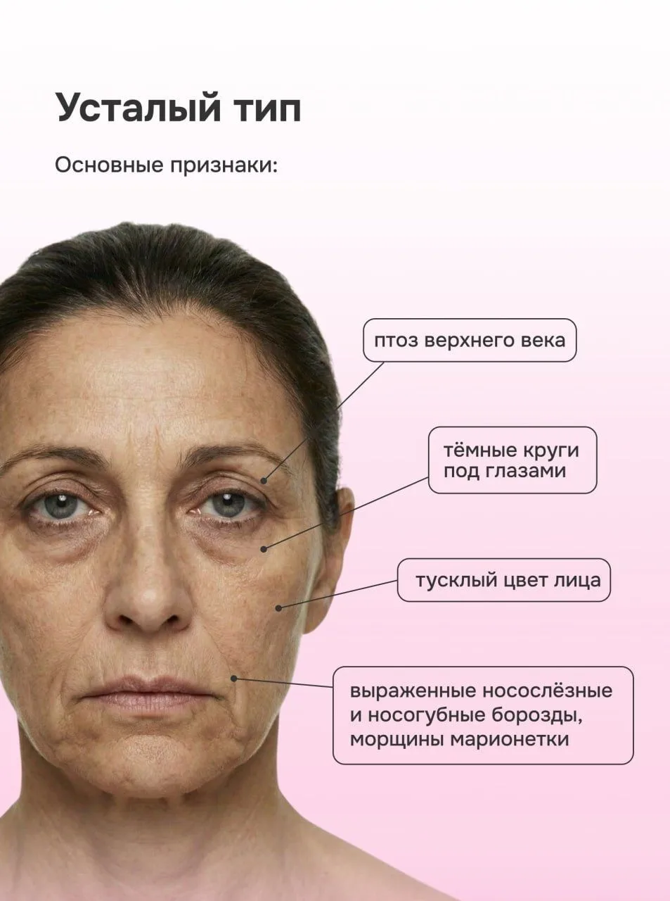 Как подобрать anti-age уход по типу старения?  Остановить время мы не можем, зато вполне способны до