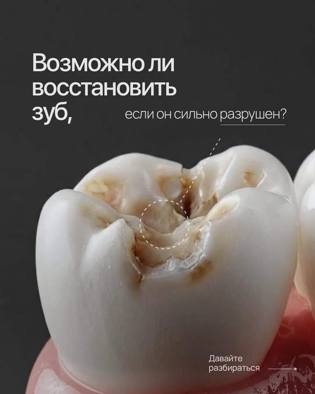 🦷 Не откладывайте визит к стоматологу!

Маленькая дырочка сегодня — большая проблема завтра. Своевр