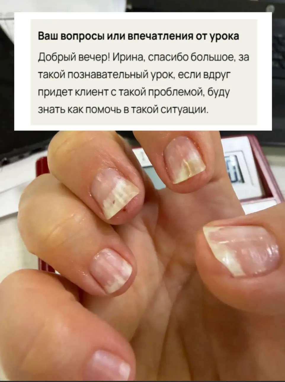 Клиентка пришла с такими ногтями 👆