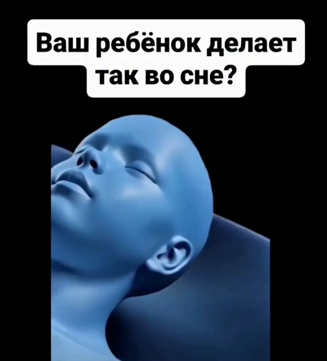 🦷 Ребёнок скрипит зубами во сне? Это не всегда просто привычка или «нервы».