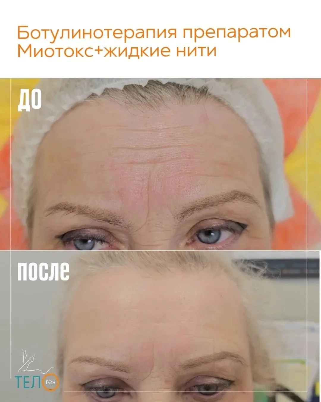 Забота о себе актуальна в любом возрасте🤍