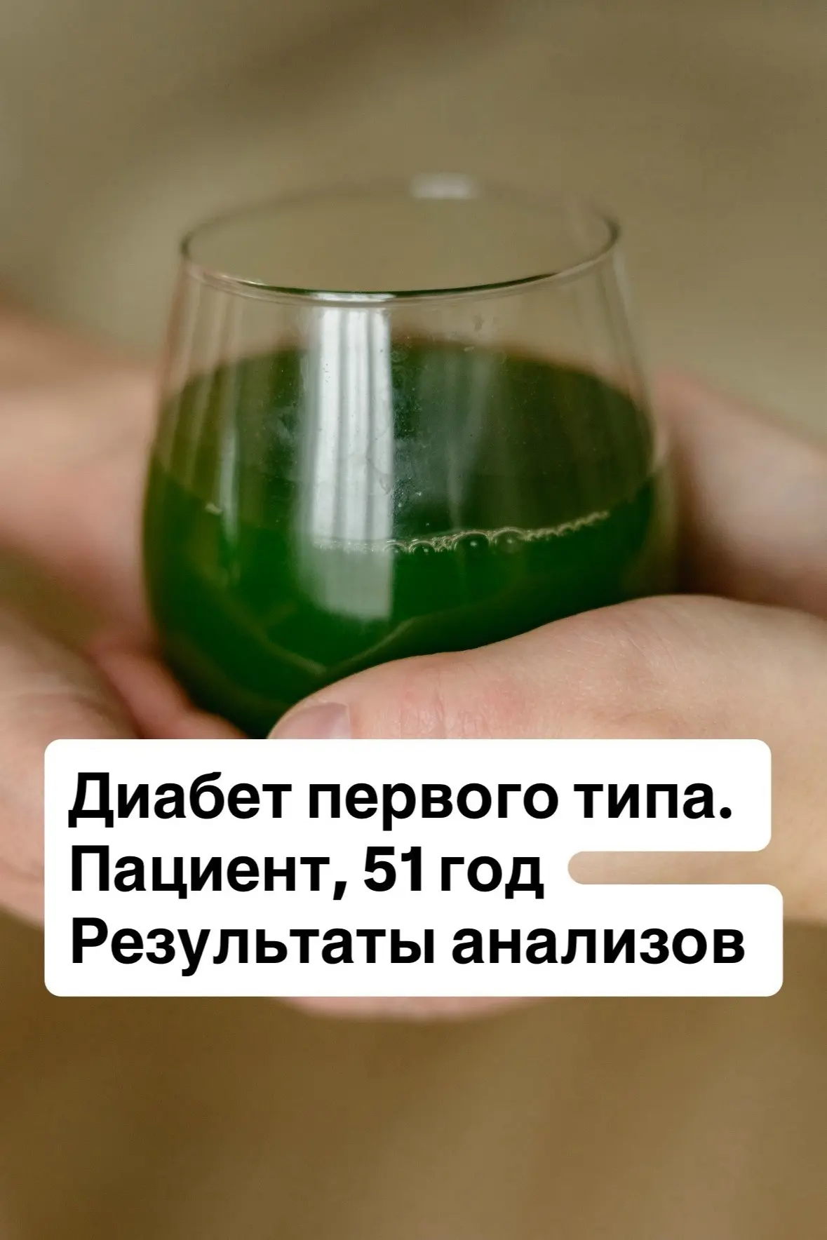 Диабет первого типа. Пациент, 51 год. Наше исследование сока витграсс, подкрепленное ан...