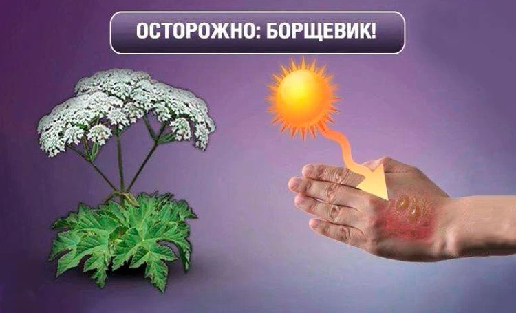 Борщевик — ядовитое растение.

Его сок содержит светочувствительные вещества — фурокумарины. В тени 