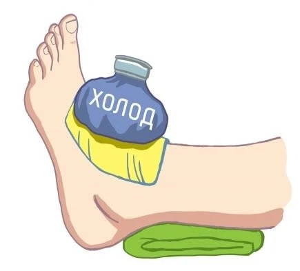 ↗️Первая медицинская помощь сразу же посла ушиба должна быть направлена на уменьшение б...