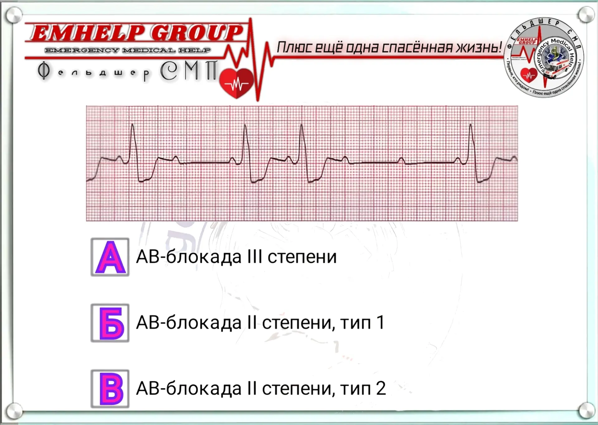 Что на ЭКГ?