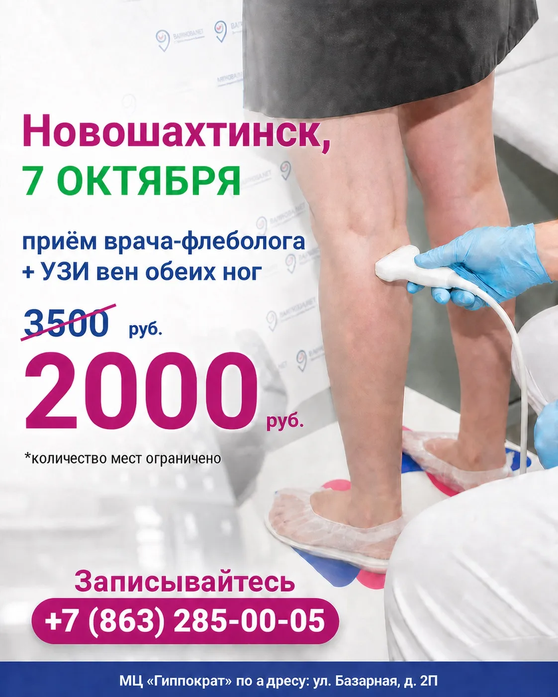 Акция! Приём врача-флеболога + УЗИ вен обеих ног всего за 2000 рублей! (вместо 3500р)