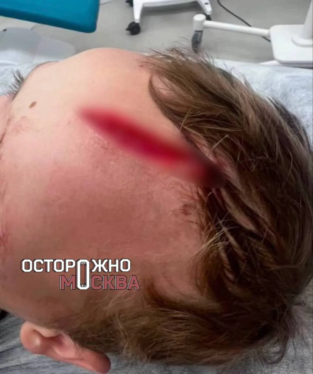 В Одинцово собака набросилась на 7-летнего внука Дарьи Донцовой — мальчика спасли врачи...