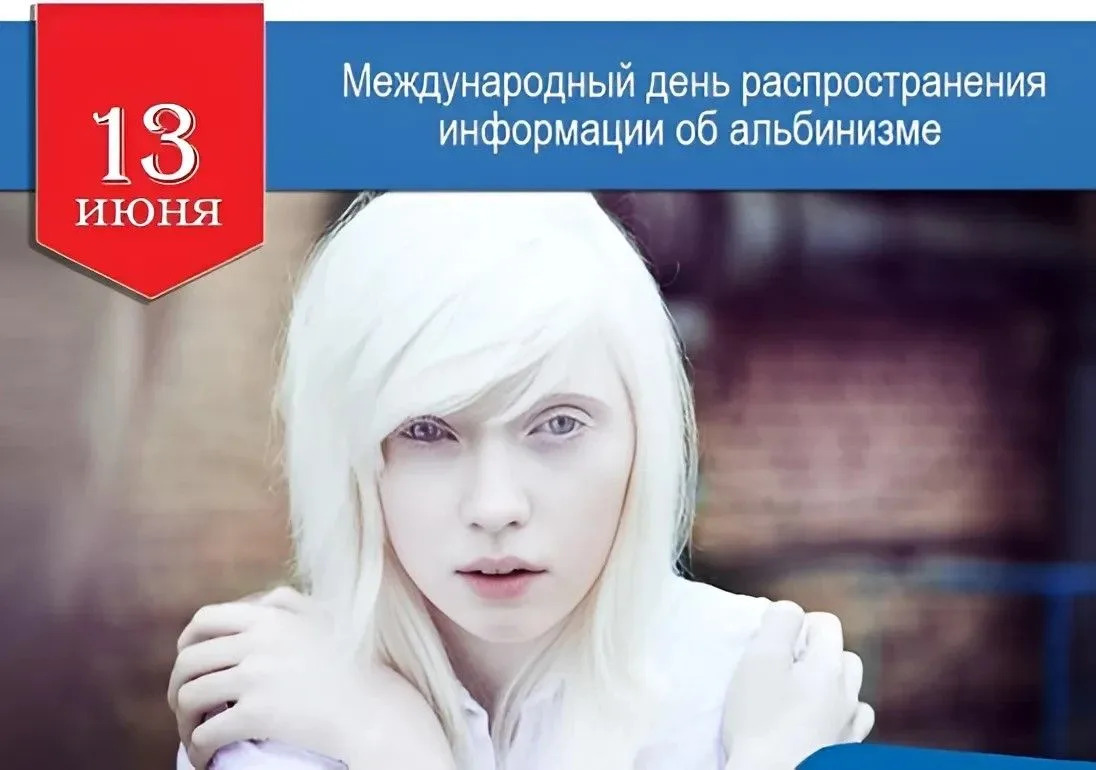 🧬 13 июня — Международный день распространения информации об альбинизме

❓ Что такое альбинизм?
Аль