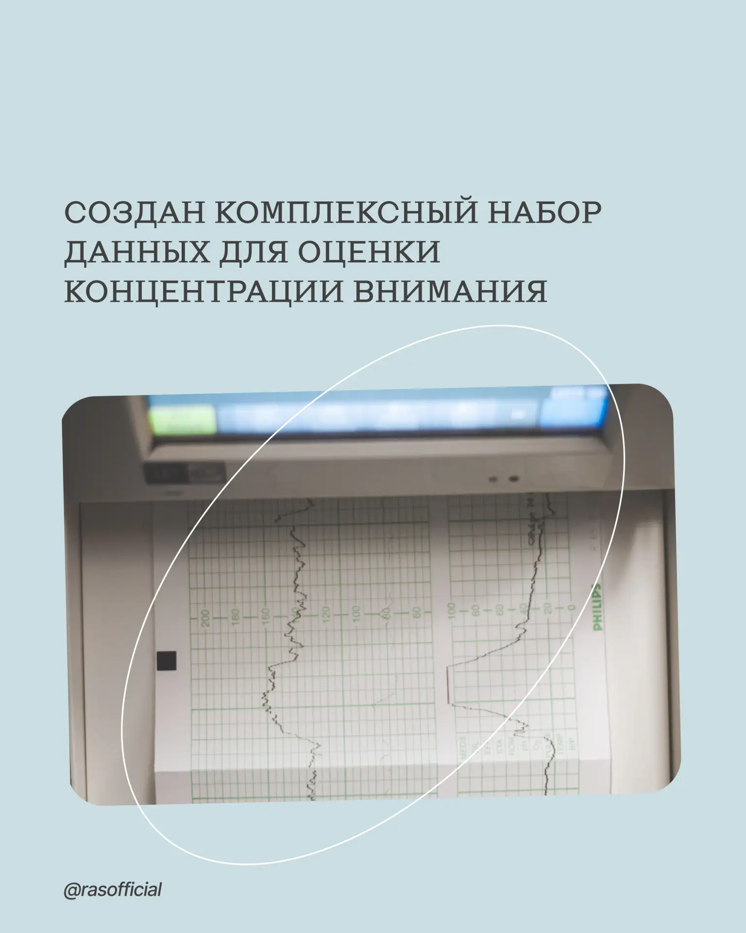 Создан комплексный набор данных для оценки концентрации внимания

Учёные Санкт-Петербургского Федера