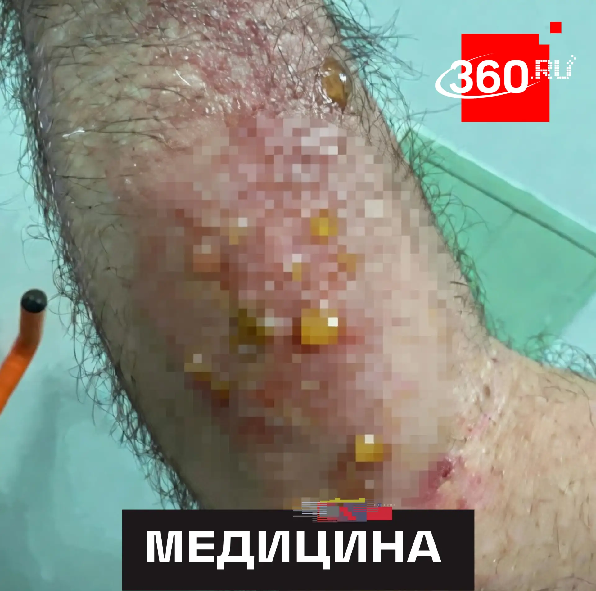 Москвич решил прокачать иммунитет на максималках и завел дома гадюку в качестве… персон...