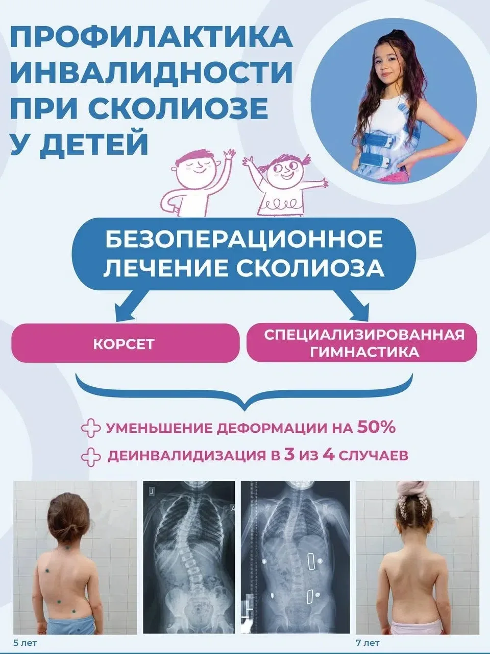 Сколиоз у детей — тихая угроза, которая не проходит сама!

Подавляющее большинство детей имеют пробл