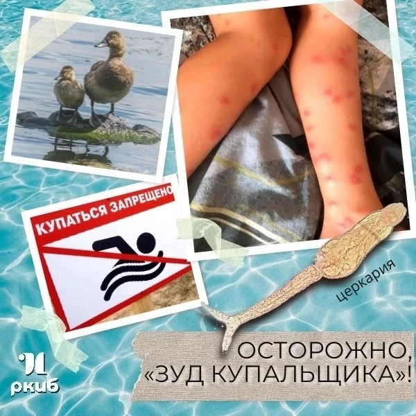 ❗Осторожно, «Зуд купальщика»! Что нужно знать о церкариозе этим летом? 🦟

Доброе утро,  дорогие дру