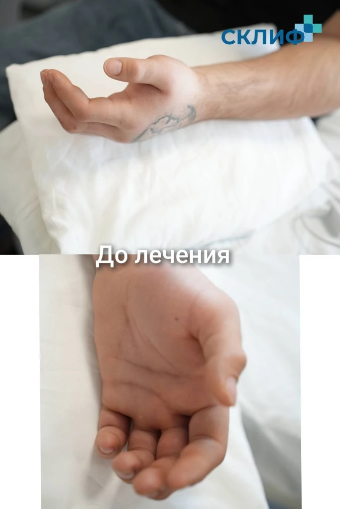 😱 Пациента Склифа укусила голубая куфия