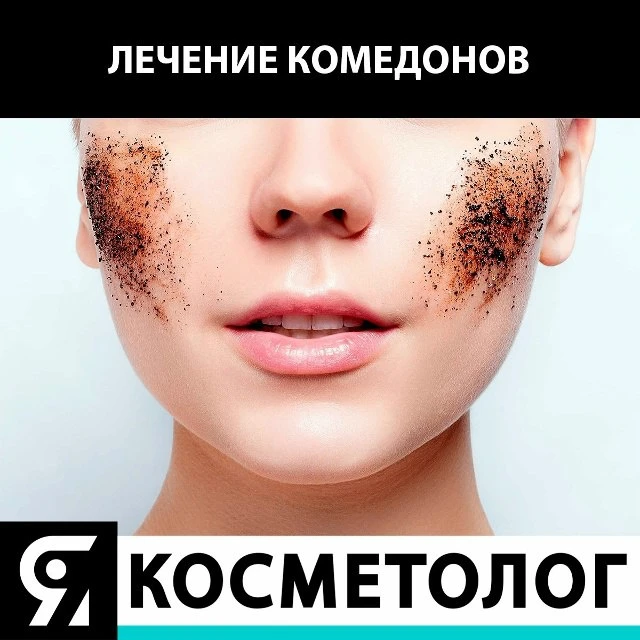 💧❔Ретинол, кислоты и витамин С: как сочетать активы без вреда для кожи?