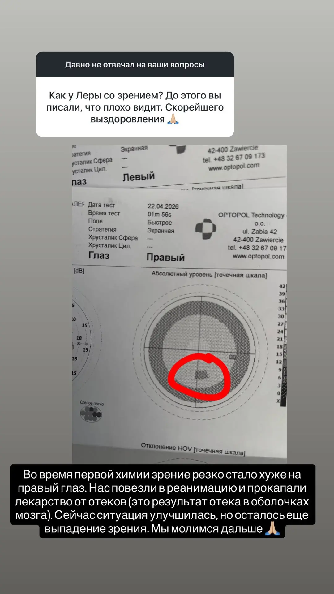 Возлюбленный Лерчек после подозрений прокуратуры в фейковой болезни блогерши поспешил о...