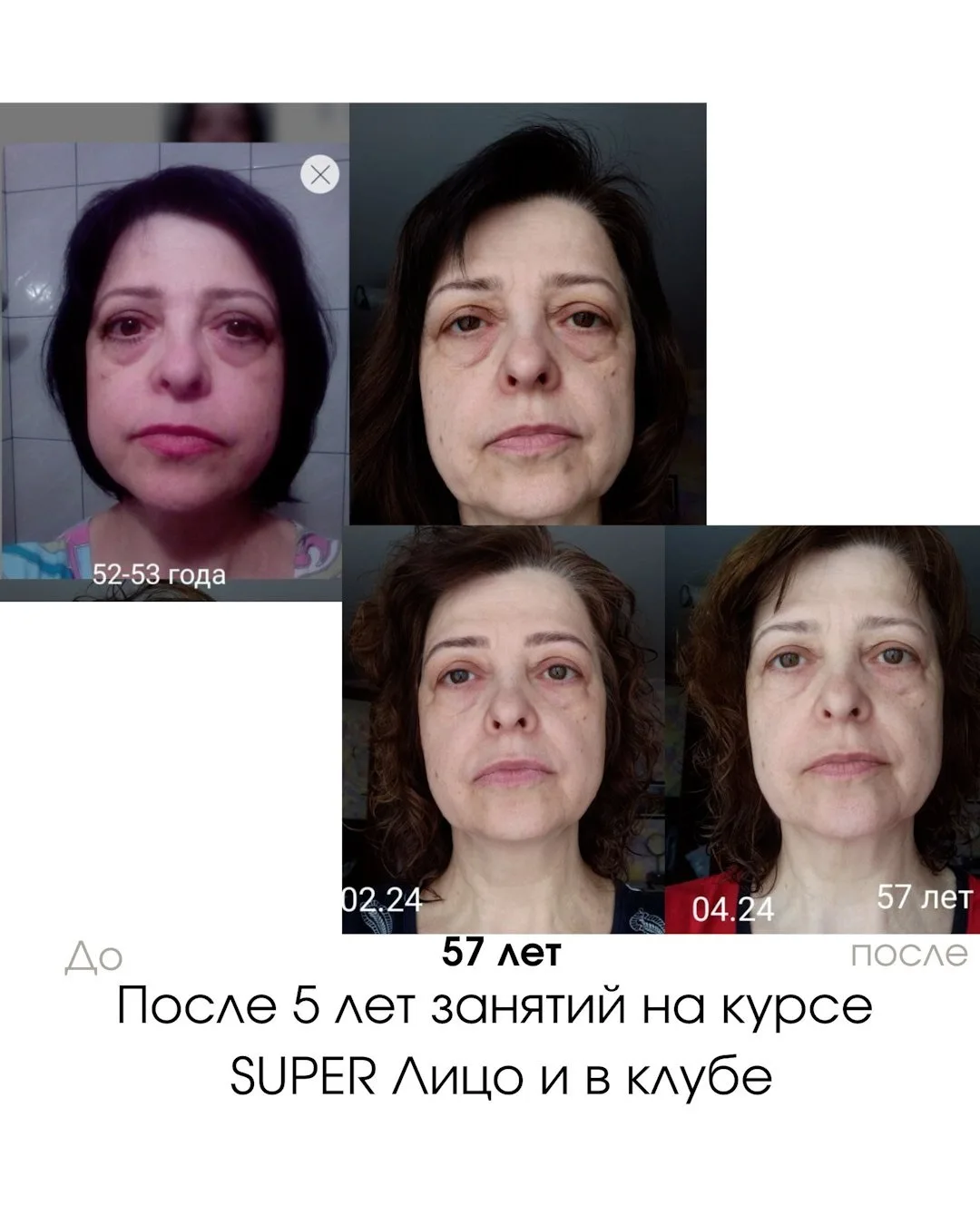 Изображение 1 к публикации «Гимнастика для лица»