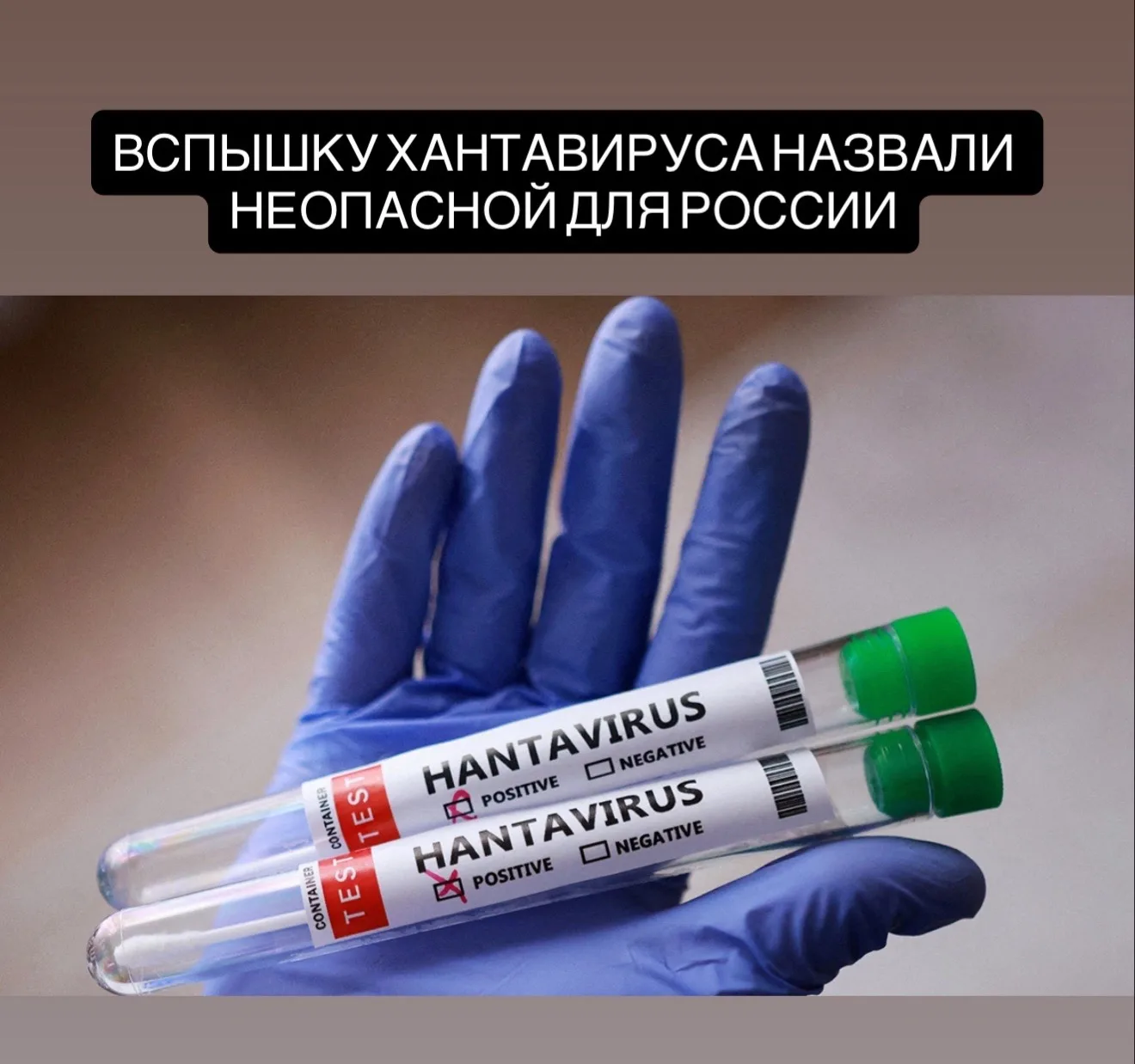 Хантавирус не представляет угрозы для россиян.  По словам академиков РАН, вирус давно изучен, а мето