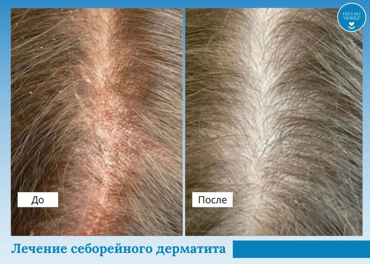 КЛИНИЧЕСКИЙ СЛУЧАЙ