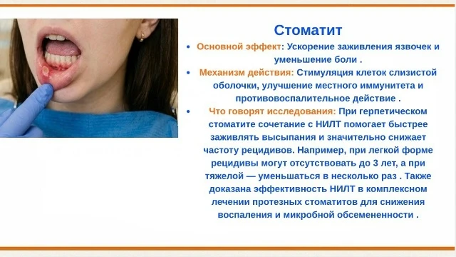 Как лазер ОРИОН помогает при проблемах с зубами? 🦷