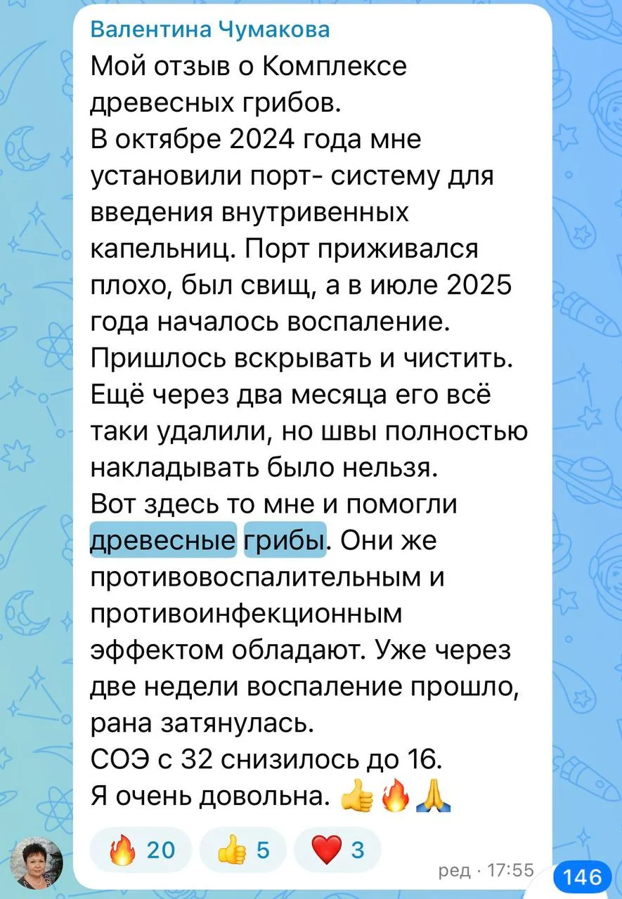 ДРЕВЕСНЫЕ ГРИБЫ - волшебные, что ли?)))