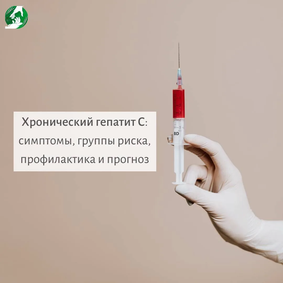 Хронический гепатит С — это вирусное инфекционное заболевание, с преимущественным пораж...