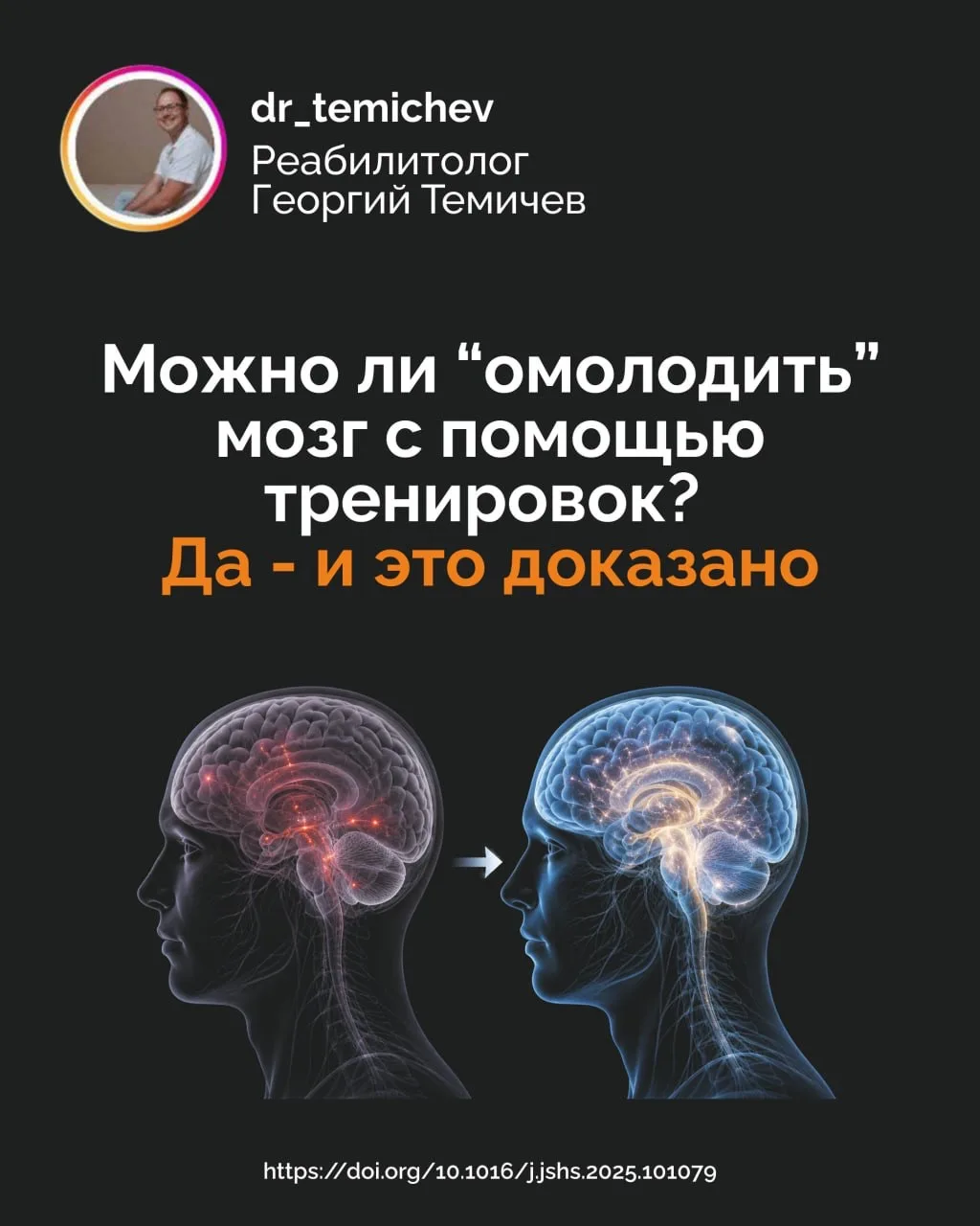 Можно ли “омолодить” мозг с помощью тренировок? 

Да - и это доказано

С возрастом все более остро в