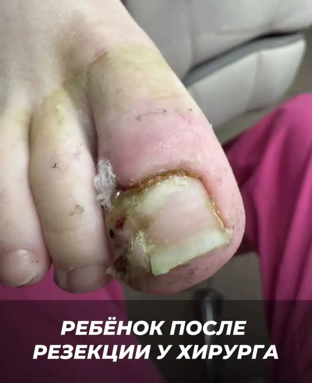 Когда ребёнку больно — родители, как Чип и Дейл, спешат на помощь 🤍