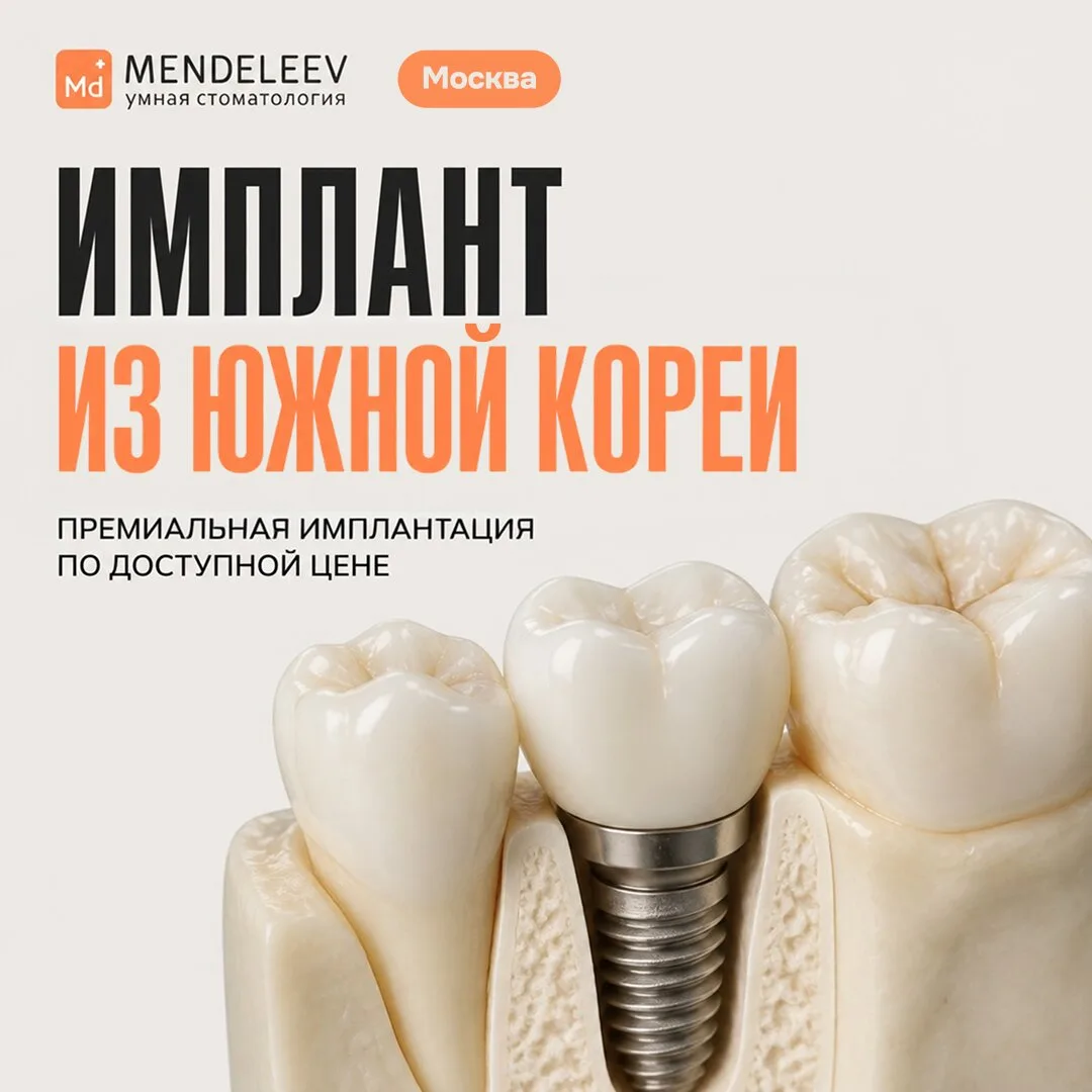 Имплантация зубов по выгодной цене! Импланты Ю.Корея